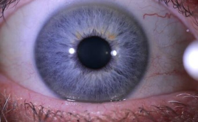 Close-up eines Auges Close-up eines Auges