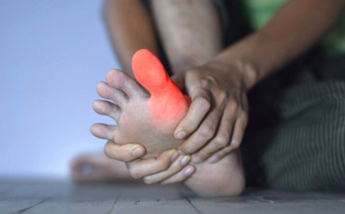 Gicht mit Knieschmerzen Entzündung des großen Zehs eines asiatischen Mannes. Konzept von Fußgelenksschmerzen, Stolpern, Arthritis, Hyperurikämie oder Gicht.